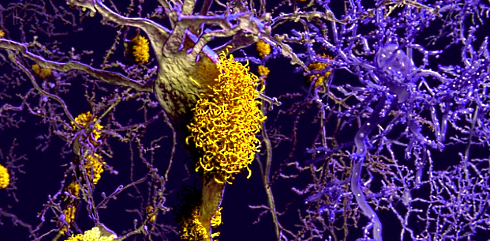 Test-tube study: ashwagandha inhibits Alzheimer's