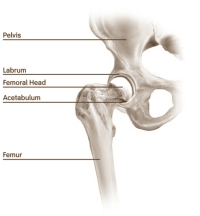 Runners put strain on their knees and hip joints, and sooner or later many need a hip replacement. That's what you'd think isn't it? But it's not necessarily the case. The biggest study undertaken so far actually shows that runners are less likely to develop osteoarthritis than less active people. But that doesn't have to mean that running is good for your joints