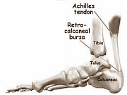 Anabolic steroids prevent tendons from becoming stronger through training