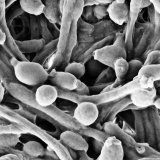 The use of anabolic steroids makes Candida fungi even more aggressive