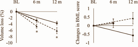 Chondroitin sulphate protects knee joints