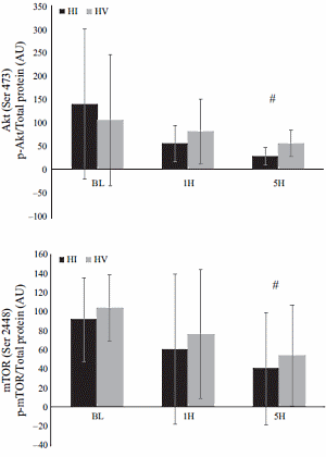 Muscle growth is the same whether you do high-intensity or high-volume resistance training