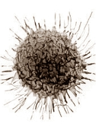Prostate Cancer Cell