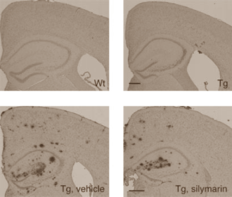 Animal study: milk thistle inhibits Alzheimer's
